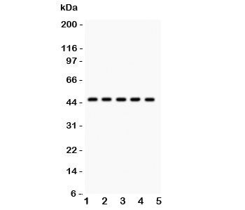 Western blot testing of PIM-1 antibody and human samples 1: U20S; 2: A549; 3: COLO320; 4: SW620; 5: 