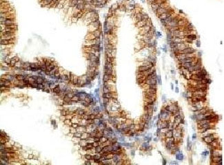 E-Cadherin Antibody / CDH1
