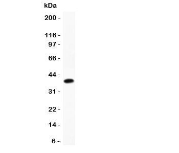 Cathepsin D Antibody
