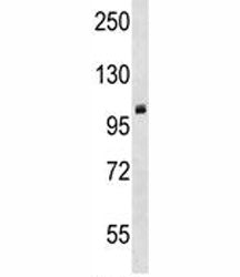 PRMT10 Antibody