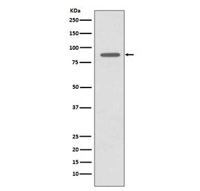 Western blot testing of human LNCaP cell lysate with HMMR antibody. Expected molecular weight ~72 kD