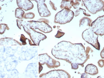 CD105 Antibody / Endoglin