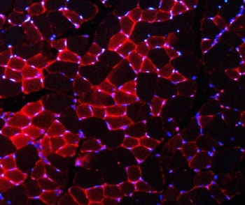 Immunofluorescent staining of FFPE mouse skeletal muscle with Nedd4 antibody (red) and DAPI nuclear 