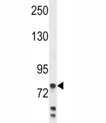 Myeloperoxidase Antibody