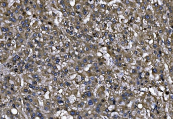 ENAH Antibody / MENA