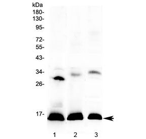 Western blot testing of 1) human placenta, 2) rat spleen and 3) mouse spleen lysate with HBD antibod