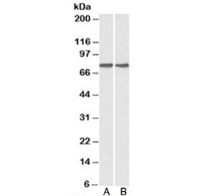 GRP78 Antibody (BiP)