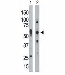 PKR Antibody (PRKR)