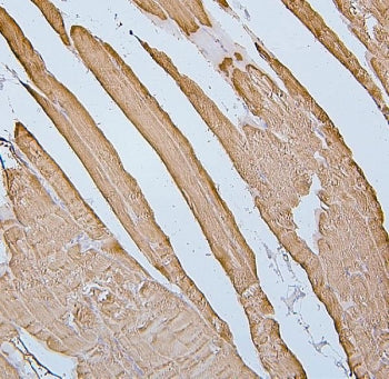 Desmin Antibody