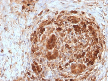 IHC staining of FFPE human pancreas with FTH antibody. HIER: boil tissue sections in pH 9 10mM Tris 