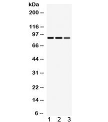 Western blot testing of 1) rat spleen, 2) rat lung, 3) mouse HEPA lysate with MEFV antibody. Expecte