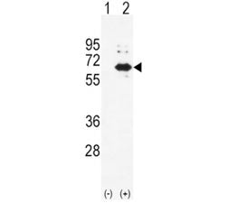 Alkaline Phosphatase Antibody (liver)