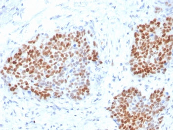 IHC staining of FFPE human pancreas with recombinant SOX9 antibody. HIER: boil tissue sections in pH