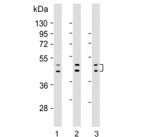 UGT2B4 Antibody