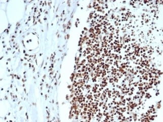 Ku80 Antibody / XRCC5