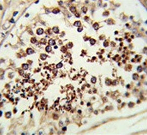 SMAC/Diablo Antibody