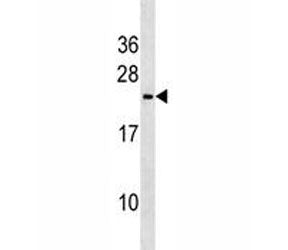 Trem2 Antibody