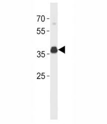 ER Antibody (isoform 4)