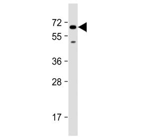 Western blot testing of human U-251 MG cell lysate with SH2B3 antibody at 1:2000. Predicted molecula