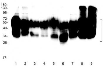Western blot testing of human 1) HeLa, 2) placenta, 3) Jurkat, 4) U-2 OS, 5) K562, 6) MCF-7, 7) COLO