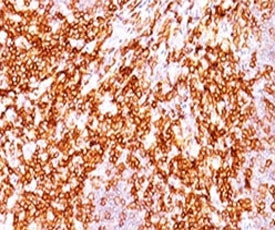 IHC testing of FFPE human tonsil and CD68 antibody (clone LAM34-1). FFPE testing requires sections t