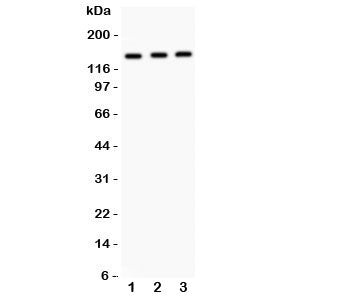 Western blot testing of IRS1 antibody and Lane 1: A549; 2: MM453; 3: Jurkat. Expected size: 132~185K
