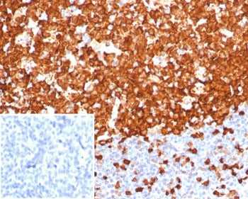 IHC staining of FFPE human tonsil tissue with Stathmin 1 antibody (clone STMN1/8001R). Inset: PBS us