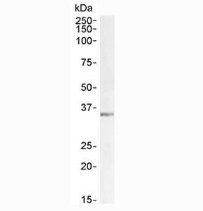 LDHC Antibody
