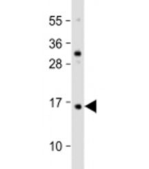 Western blot testing of human HaCaT cell lysate with TCTA antibody at 1:2000. Predicted molecular we