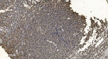 hnRNP H3 Antibody / HNRNPH3