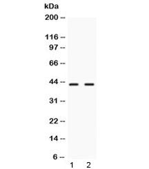 Western blot testing of 1) rat liver and 2) human HeLa lysate with NR2F6 antibody at 0.5ug/ml. Predi