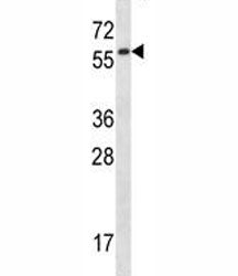 Fyn Antibody