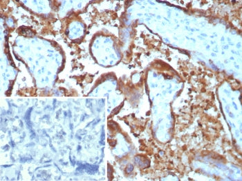 EBI3 Antibody / Epstein-Barr virus induced 3