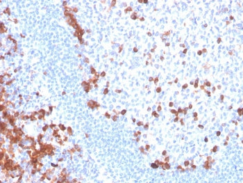 IHC staining of FFPE human tonsil with B7-H6 antibody. HIER: boil tissue sections in pH 9 10mM Tris 