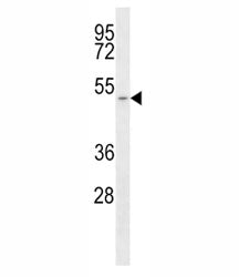 MCT1 Antibody