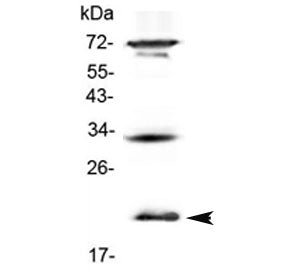 Il-17b / Il-20 Antibody