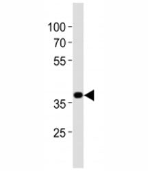 Nkx2-5 Antibody