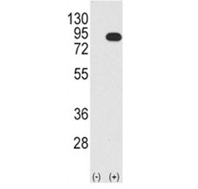 B-RAF Antibody