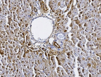 Alanine aminotransferase 1 Antibody