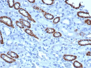 TOM1L1 Antibody