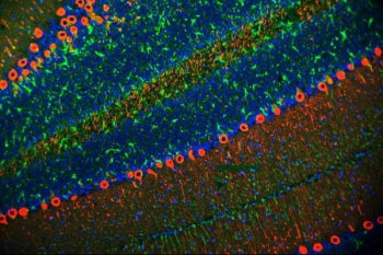 PKC gamma Antibody / PRKCG