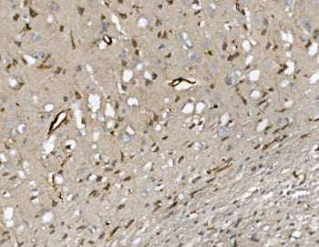 IHC staining of FFPE rat brain with Cd34 antibody. HIER: boil tissue sections in pH8 EDTA for 20 min