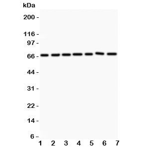 Western blot testing of ANG1 antibody and Lane 1: HeLa; 2: MCF-7; 3: COLO320; 4: A549; 5: HEPG2; 6: 