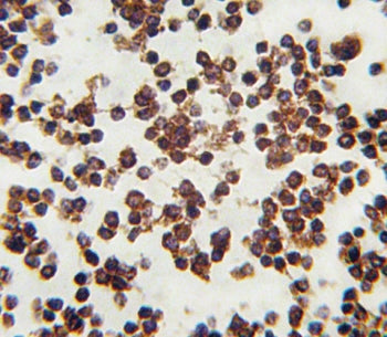 ALOX15 Antibody