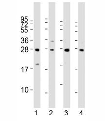 Western blot analysis of LIN28B antibody and 1) HeLa, 2) K562, 3) mouse testis and 4) NCCIT lysate. 