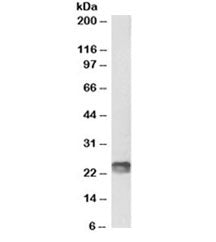 SOCS1 Antibody [Biotin Conjugate]