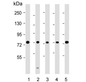 Western blot testing of human 1) MCF7, 2) HeLa, 3) SH-SY5Y, 4) Jurkat and 5) HL60 cell lysate with K