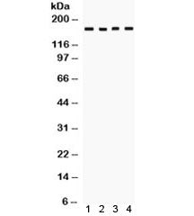HKDC1 Antibody