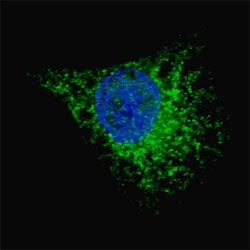 LC3A Antibody (MAP1LC3A)