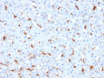 C1QB Antibody / Complement C1q B-Chain